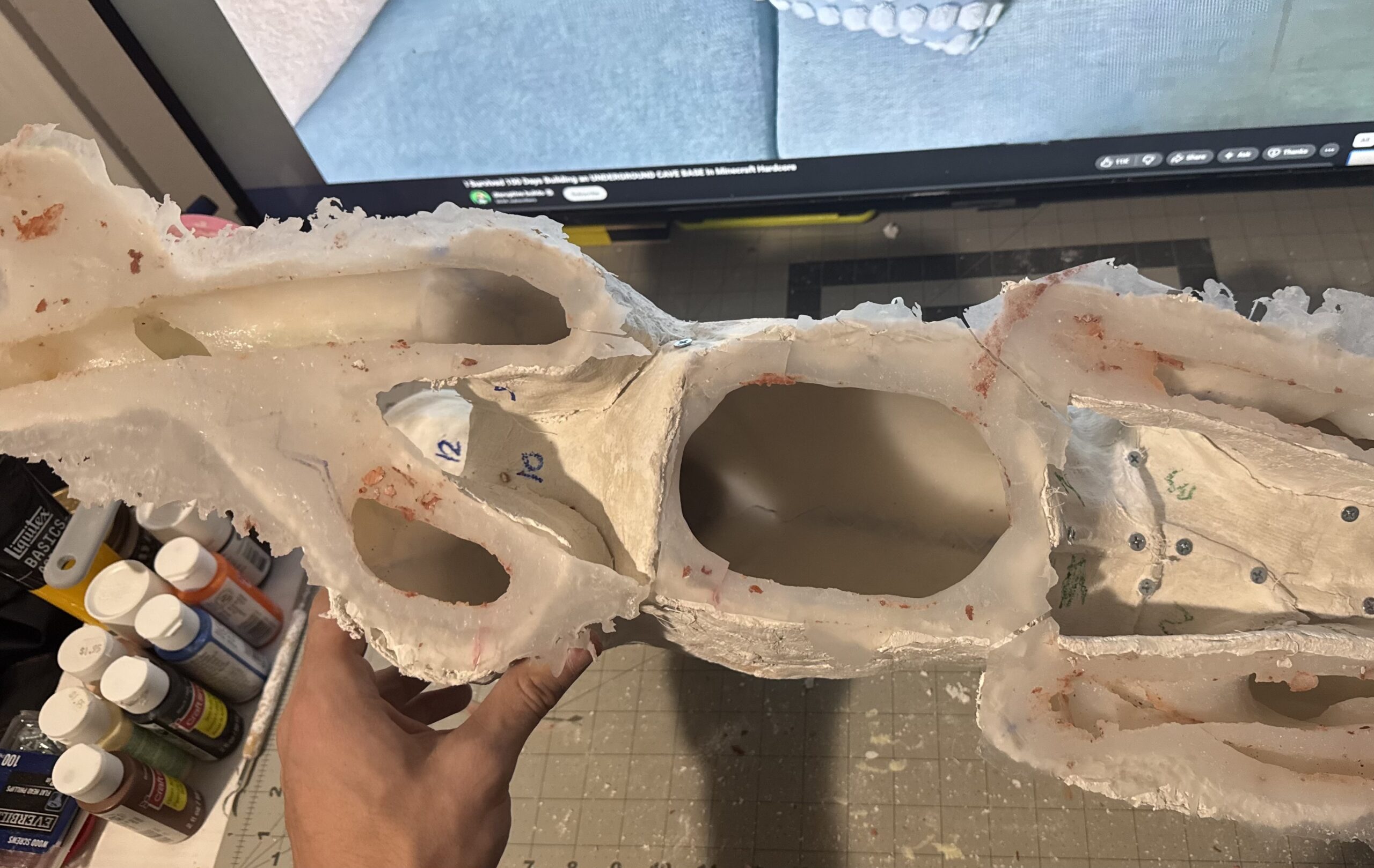 Opened plaster jacket